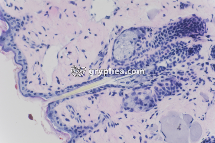 Peau avec glandes sébacées x100 - gryphea.org